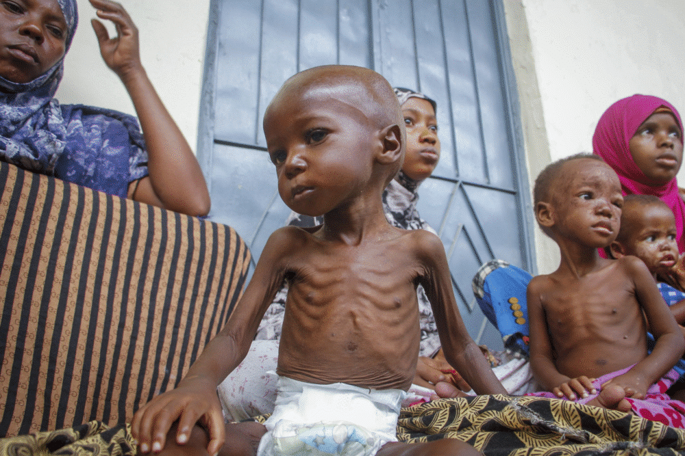 Read more about the article 2.5m children at risk of acute malnutrition in north-east Nigeria – UNICEF