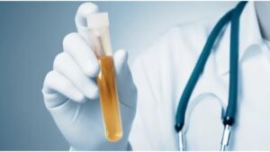 Read more about the article FG mandates drug tests for public service employment