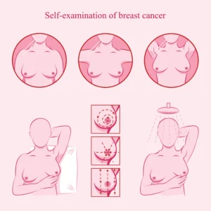 Read more about the article How to self-screen for breast cancer